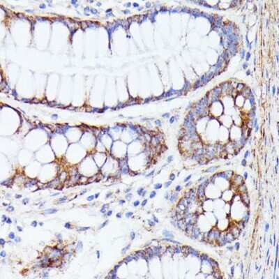 Immunohistochemistry-Paraffin: PRL-2/PTP4A2 Antibody - Azide and BSA Free [NBP2-93937]