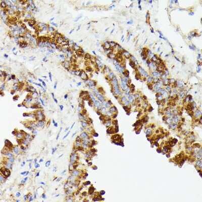 Immunohistochemistry-Paraffin: PRL-2/PTP4A2 Antibody - Azide and BSA Free [NBP2-93937]