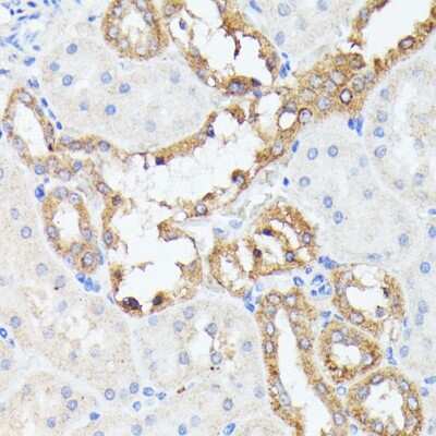 Immunohistochemistry-Paraffin: PRL-2/PTP4A2 Antibody - Azide and BSA Free [NBP2-93937]