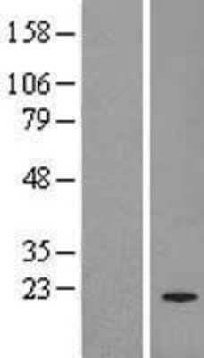 Western Blot: PRL-3/PTP4A3 Overexpression Lysate [NBL1-14961]