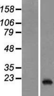 Western Blot: PRL-3/PTP4A3 Overexpression Lysate [NBP2-05990]