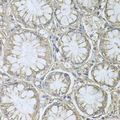 Immunohistochemistry-Paraffin: PRL-3/PTP4A3 Antibody - BSA Free [NBP2-93734]