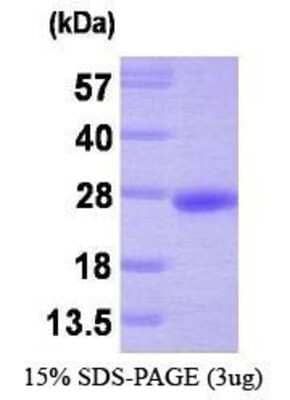 SDS-PAGE: Recombinant Human PRL-3/PTP4A3 His Protein [NBP1-30246]