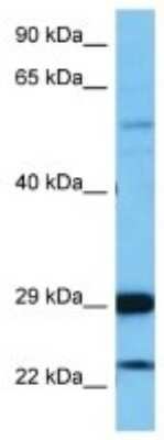 Western Blot: PRL7A2 Antibody [NBP3-10233]