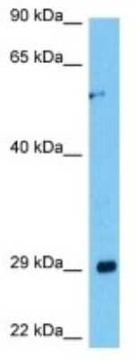 Western Blot: PRL7C1 Antibody [NBP3-10221]