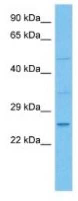 Western Blot: PRL8A9 Antibody [NBP3-10215]