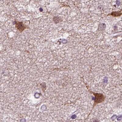 Immunohistochemistry: PRLH Antibody [NBP2-68591]