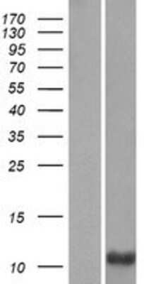 Western Blot: PRM3 Overexpression Lysate [NBP2-06540]