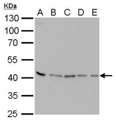 Western Blot: PRMT1 Antibody (10111) [NBP2-43818]