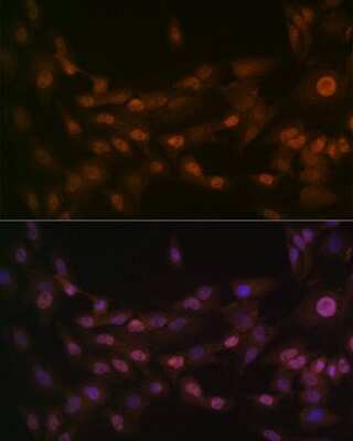 Immunocytochemistry/ Immunofluorescence: PRMT1 Antibody (10W10U4) [NBP3-16423]