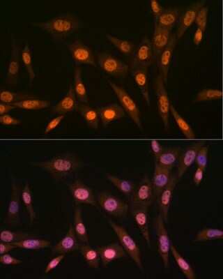 Immunocytochemistry/ Immunofluorescence: PRMT1 Antibody (10W10U4) [NBP3-16423]
