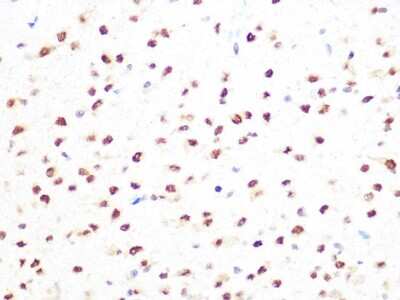 Immunohistochemistry-Paraffin: PRMT1 Antibody (10W10U4) [NBP3-16423]