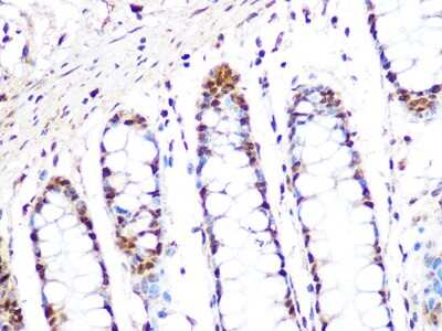 Immunohistochemistry-Paraffin: PRMT1 Antibody (10W10U4) [NBP3-16423]