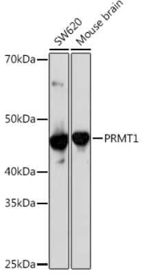 Western Blot: PRMT1 Antibody (10W10U4) [NBP3-16423]