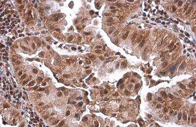 Immunohistochemistry-Paraffin: PRMT1 Antibody (779) [NBP2-43744]
