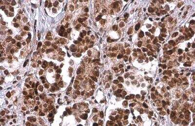 Immunohistochemistry-Paraffin: PRMT1 Antibody (779) [NBP2-43744]