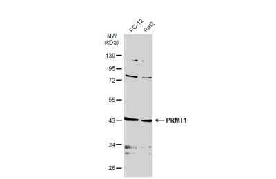 Western Blot: PRMT1 Antibody (779) [NBP2-43744]