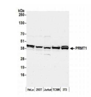 Western Blot: PRMT1 Antibody [NB100-2251]