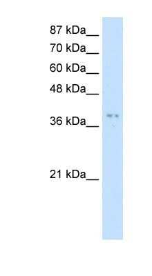 Western Blot: PRMT1 Antibody [NBP1-56501]