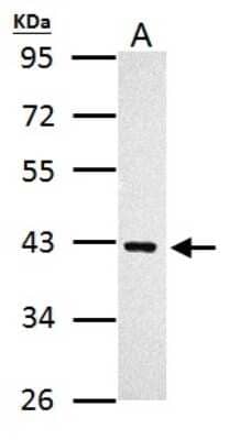 Western Blot: PRMT1 Antibody [NBP2-19300]