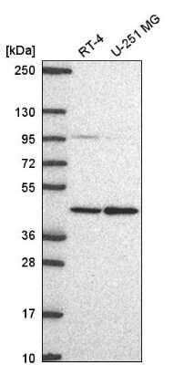 Western Blot: PRMT1 Antibody [NBP2-58031]