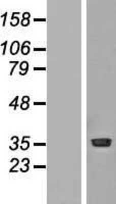 Western Blot: PRMT1 Overexpression Lysate [NBP2-04723]