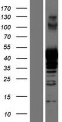 Western Blot: PRMT1 Overexpression Lysate [NBP2-09773]