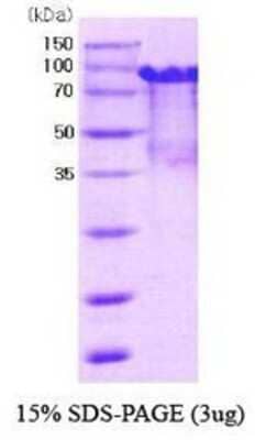 SDS-PAGE: Recombinant Mouse PRMT1 His-MBP Protein [NBC1-18445]