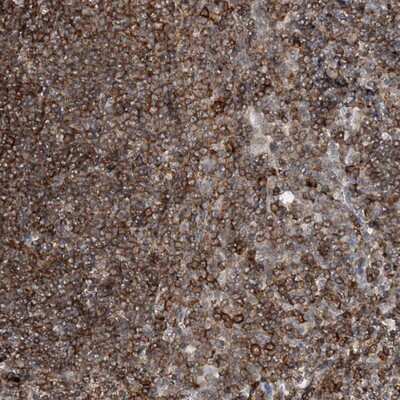 Immunohistochemistry-Paraffin: PRMT10 Antibody [NBP1-81887]