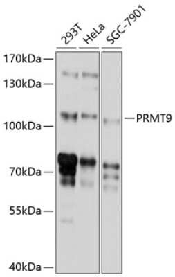 Western Blot: PRMT10 AntibodyBSA Free [NBP2-94156]