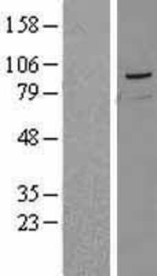 Western Blot: PRMT10 Overexpression Lysate [NBL1-12632]