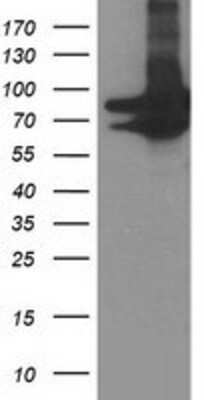 Western Blot: PRMT2 Antibody (OTI3A3) [NBP2-01291]