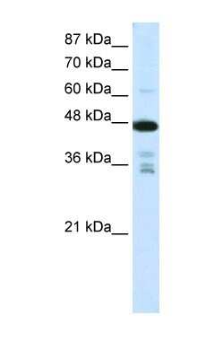 Western Blot: PRMT2 Antibody [NBP1-52944]