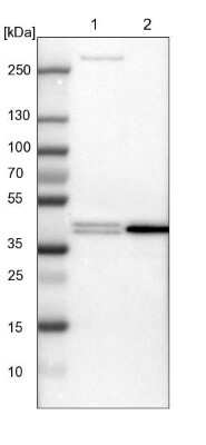 Western Blot: PRMT2 Antibody [NBP1-83206]