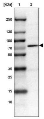 Western Blot: PRMT2 Antibody [NBP1-83207]