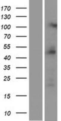 Western Blot: PRMT2 Overexpression Lysate [NBP2-04527]