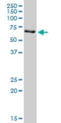 Western Blot: PRMT3 Antibody (3G4) [H00010196-M16]