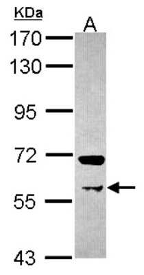 Western Blot: PRMT3 Antibody [NBP2-19933]