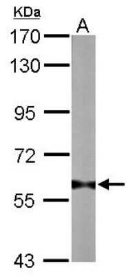 Western Blot: PRMT3 Antibody [NBP2-19933]