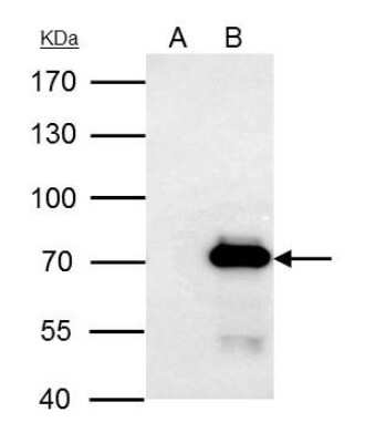 Western Blot: PRMT3 Antibody [NBP2-19933]