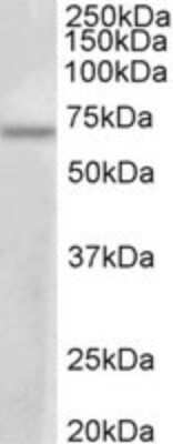 Western Blot: PRMT3 Antibody [NBP2-26133]