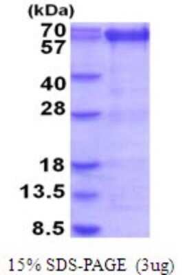 SDS-PAGE: Recombinant Human PRMT3 His Protein [NBP2-51965]