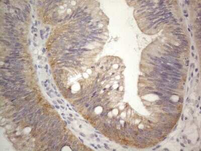 Immunohistochemistry: PRMT5 Antibody (OTI2H3) [NBP2-45394]