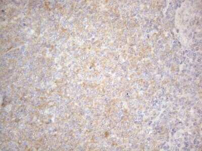 Immunohistochemistry: PRMT5 Antibody (OTI2H3) [NBP2-45394]