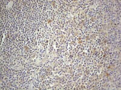 Immunohistochemistry: PRMT5 Antibody (OTI2H3) [NBP2-45394]