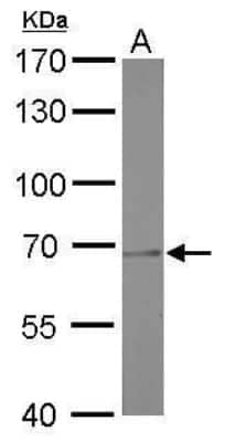 Western Blot: PRMT5 Antibody (3610) [NBP2-43678]