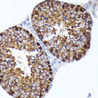 Immunohistochemistry-Paraffin: PRMT5 Antibody (7K2G5) [NBP3-15758]