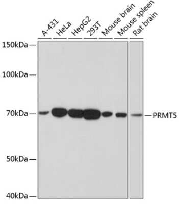 Western Blot: PRMT5 Antibody (7K2G5) [NBP3-15758]