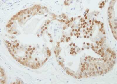 Immunohistochemistry-Paraffin: PRMT5 Antibody [NB110-40571]