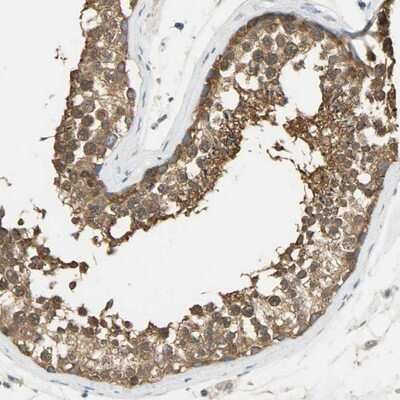 Immunohistochemistry-Paraffin: PRMT5 Antibody [NBP1-81701]